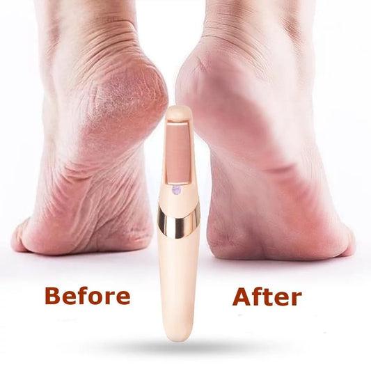 Foot Callus Remover (Rechargeable )